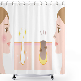 Personality  Female Face Before And After Unclogging Pore Treatment Shower Curtains