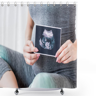 Personality  Pregnant Woman With Ultrasound Scan Shower Curtains