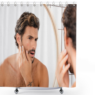 Personality  Worried Man Touching Cheek With Acne While Looking At Mirror In Bathroom  Shower Curtains