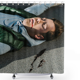 Personality  Close-up View Of Injured Young Man On Road After Traffic Accident Shower Curtains