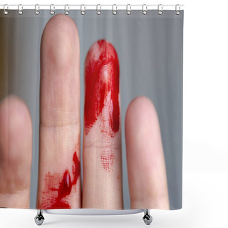 Personality  Wounded Finger, Arm With Blood, Bleeding Shower Curtains