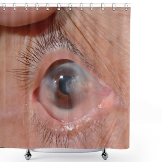Personality  Eye Exam Shower Curtains