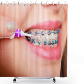 Personality  Woman Brushing Teeth With Braces Using Brush Shower Curtains