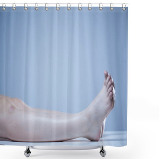 Personality  Dead Body In Morgue Shower Curtains