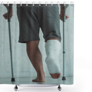Personality  Back View Of Man With Leg In Plaster Bandage Walking With Crutches Shower Curtains