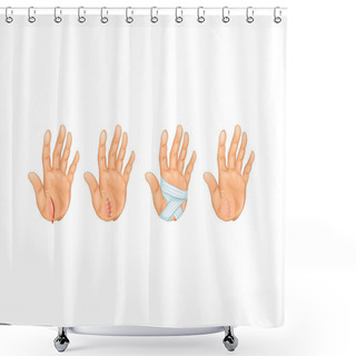 Personality  The Cut On Hand Shower Curtains