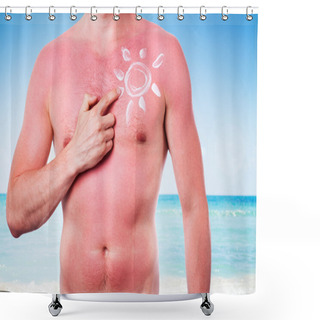 Personality  Man With A Sunburn Shower Curtains