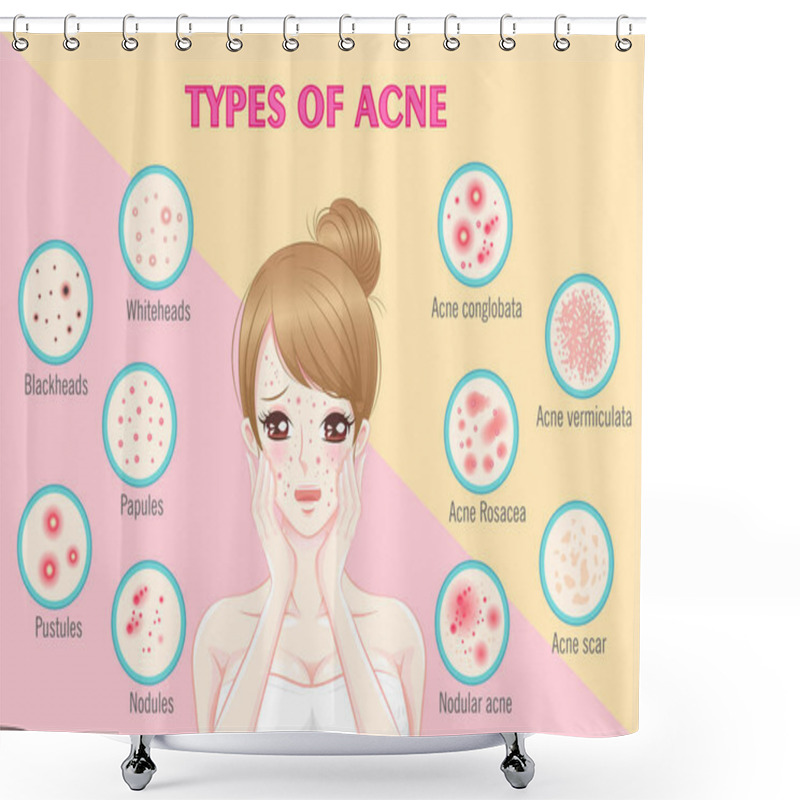 Personality  Woman With Types Of Ance Shower Curtains