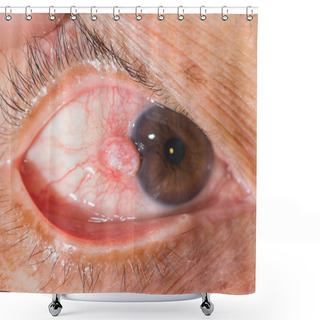 Personality  Eye Exam Shower Curtains