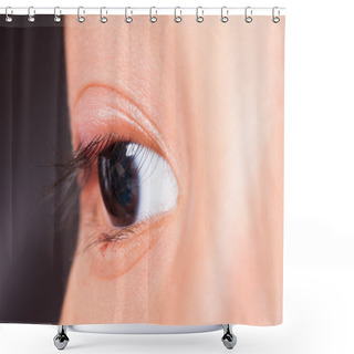 Personality  Close Up Right Upper Eye Lid Abscess, Stye Or Hordeolum Shower Curtains