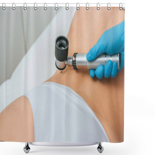 Personality  Cropped View Of Doctor Using Magnifier During Mole Removal Procedure Shower Curtains