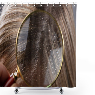 Personality  Close-up Of A Dandruff In Blonde Hair Seen Through Magnifying Glass Shower Curtains