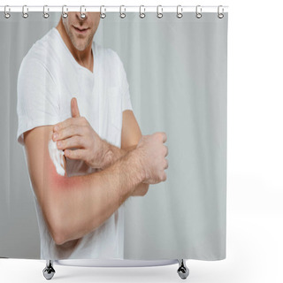 Personality  Cropped View Of Man Applying Foam On Hand With Redness Isolated On Grey Shower Curtains