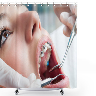Personality  Dentist Hands Working On Dental Braces. Shower Curtains