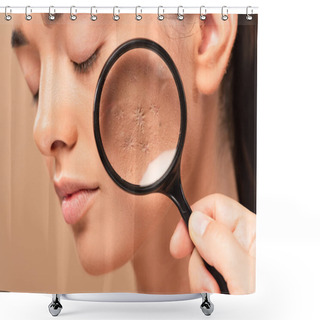 Personality  Cropped View Of Man Holding Magnifier Near Young Woman With Problem Skin Isolated On Beige  Shower Curtains