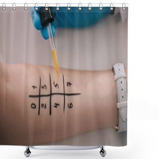Personality  Top View Of Doctor Holding Pipette With Liquid Near Marked Female Hand Shower Curtains
