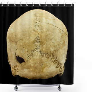 Personality  Human Skull Fracture (backside)  (Mongoloid,Asian) On Isolated B Shower Curtains