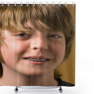 Personality  Boy With Braces On His Teeth Shower Curtains