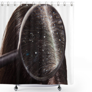 Personality  The Problem Of Dry Scalp On Dark Hair Shower Curtains