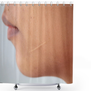 Personality  Scars On The Face Shower Curtains