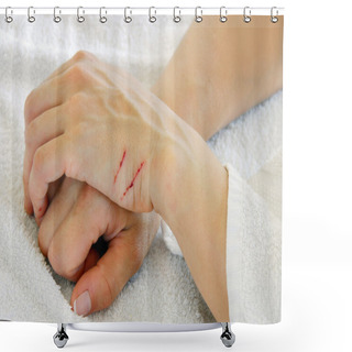 Personality  Scratched Arms Shower Curtains