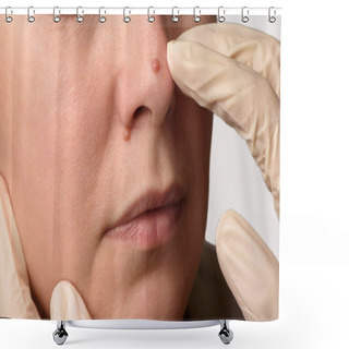 Personality  Diagnosis Of Skin Mole Or Nevus On Woman's Face. Doctor's Hands In Surgical Gloves Examining Nevi On Nose. Checking Moles Concept. Closeup Shower Curtains