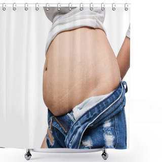 Personality  Women Body Fat Belly And Scratch Mark Shower Curtains