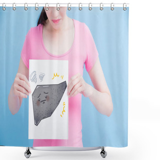 Personality  Woman With  Cirrhosis Liver Billboard On The Blue Background Shower Curtains