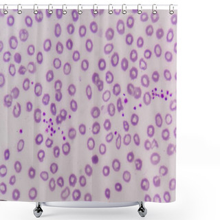 Personality  Platelet Clumping As A Possible Cause Of Low Platelet Count In P Shower Curtains