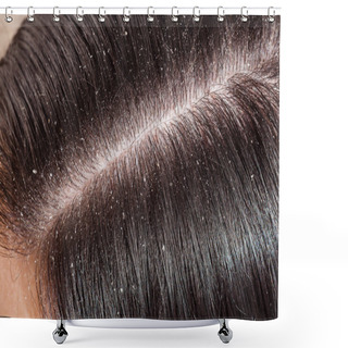 Personality  Dandruff On Woman's Dark Hair  Shower Curtains