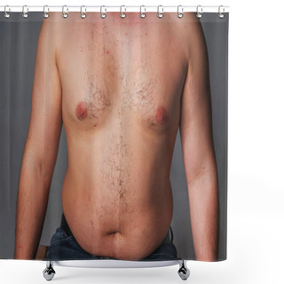 Personality  Overweight Male Torso. Naked Torso Of A Man. Hair Increased Vegetation On The Chest Of A Man Shower Curtains