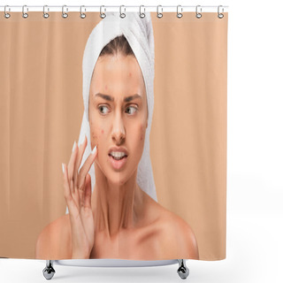 Personality  Upset Nude Girl In Towel Touching Acne On Face Isolated On Beige  Shower Curtains